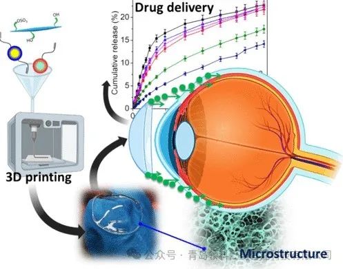 3D打印水凝胶隐形眼镜，可在眼部持续释放药物 图片